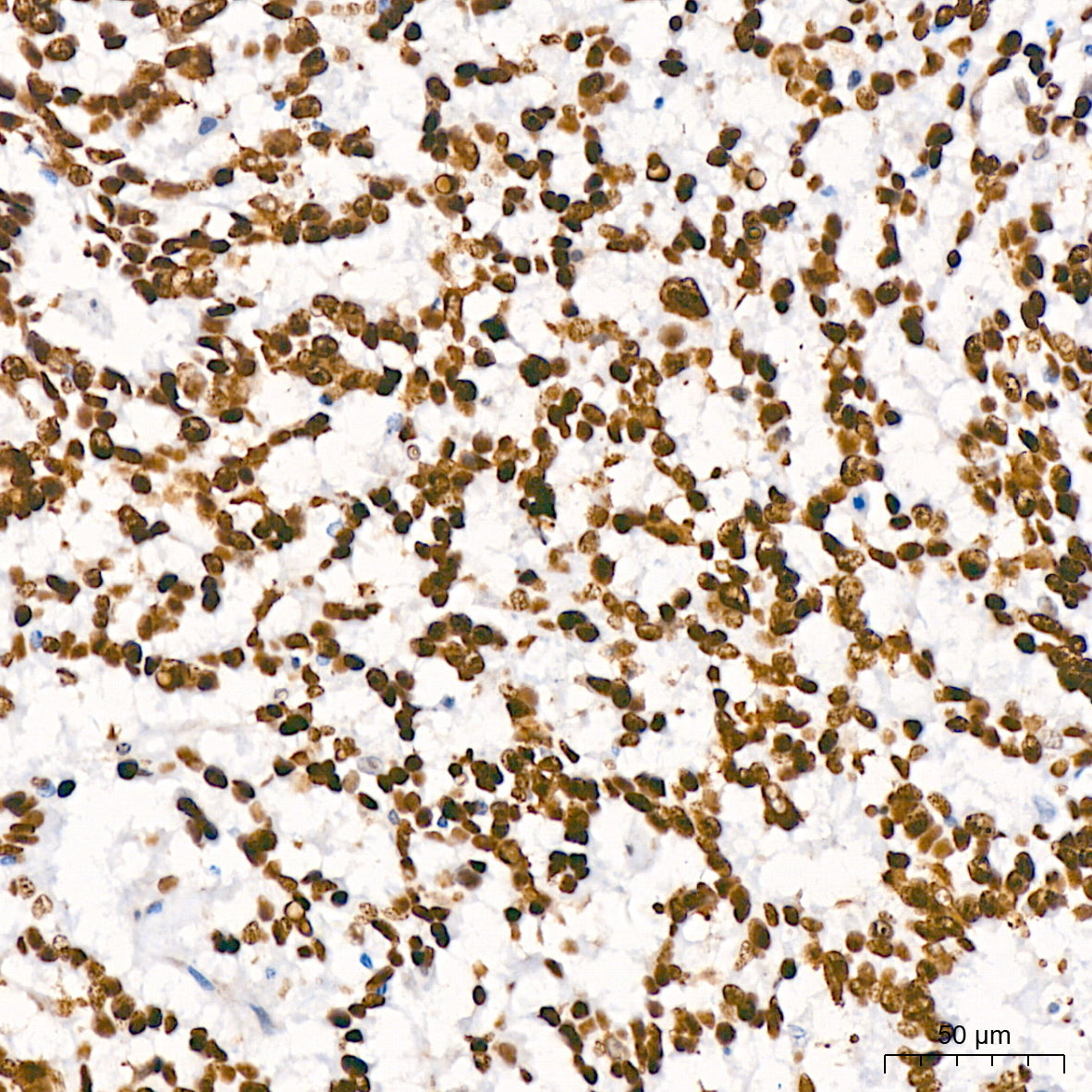 Nucleolin Rabbit mAb