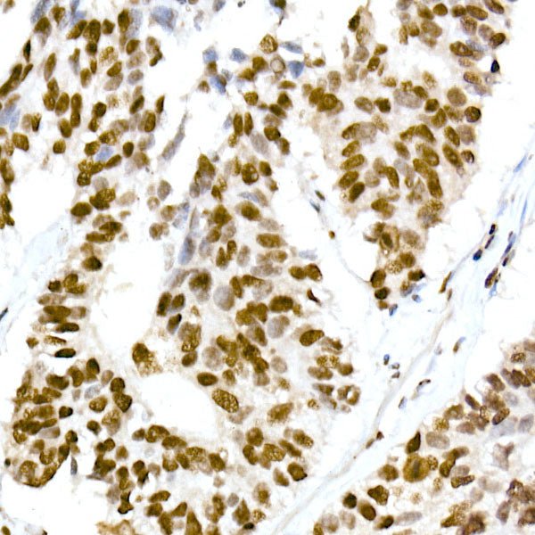 RBM3 Rabbit mAb