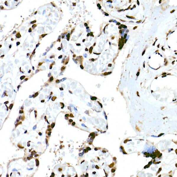 RBM3 Rabbit mAb