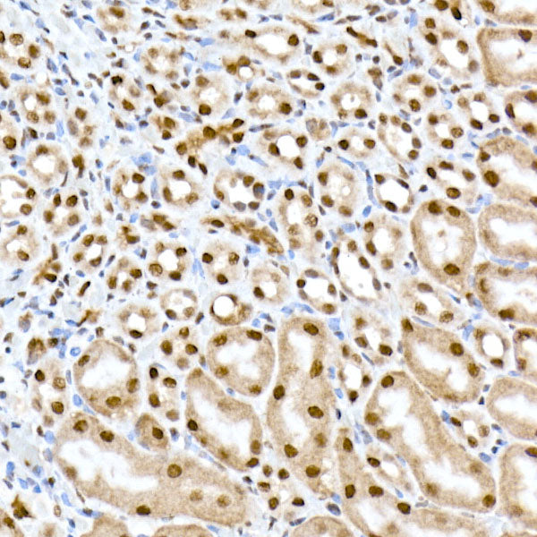 RBM3 Rabbit mAb