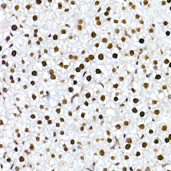 RBM3 Rabbit mAb