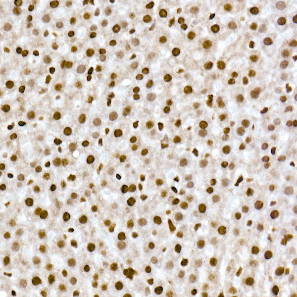 RBM3 Rabbit mAb