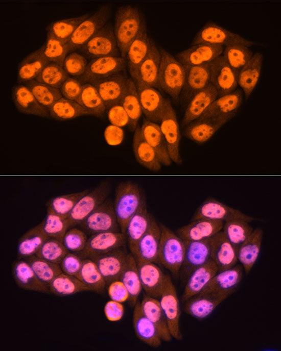 RBM3 Rabbit mAb