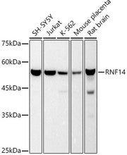 RNF14 Rabbit mAb