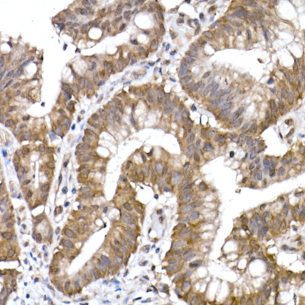PPCS Rabbit mAb