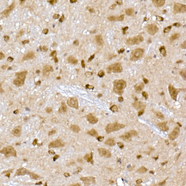 PPCS Rabbit mAb