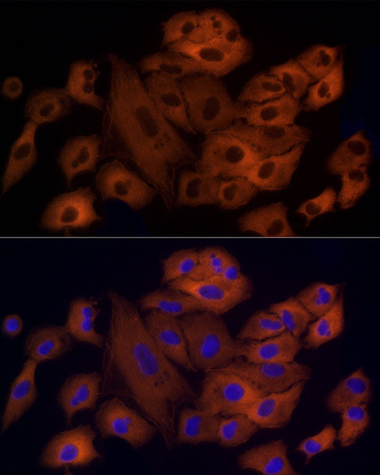 OXGR1 / GPR99 Rabbit mAb