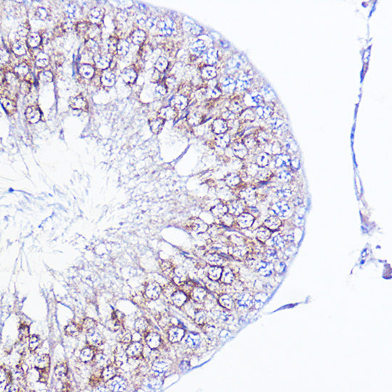 Integrin alpha V (ITGAV/CD51) Rabbit pAb