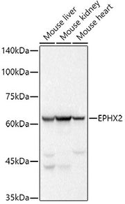 EPHX2 Rabbit mAb