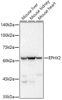 EPHX2 Rabbit mAb