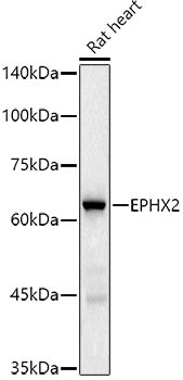 EPHX2 Rabbit mAb
