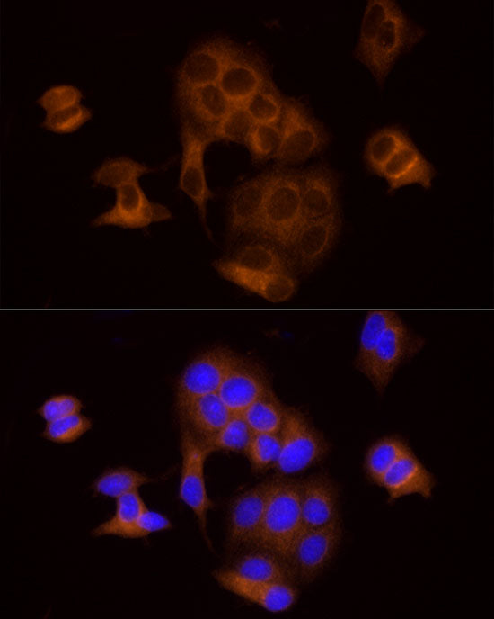 DTYMK Rabbit mAb