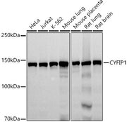 CYFIP1 Rabbit mAb