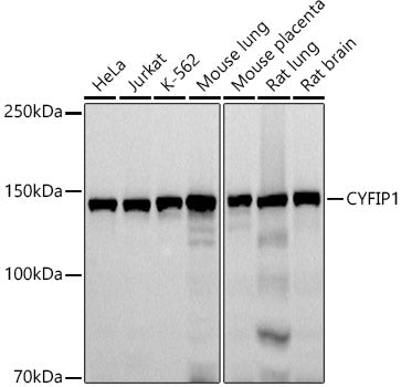 CYFIP1 Rabbit mAb
