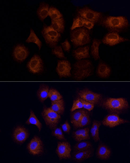 CYFIP1 Rabbit mAb