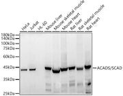 ACADS / SCAD Rabbit mAb