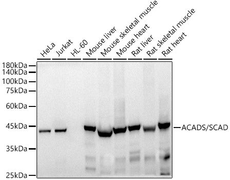 ACADS / SCAD Rabbit mAb