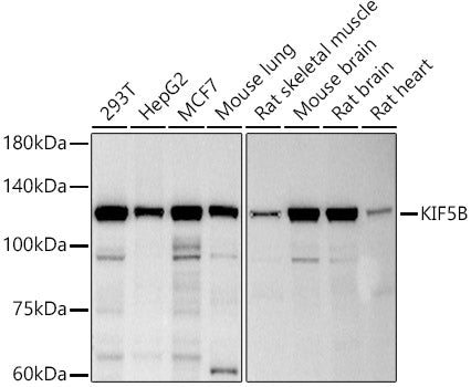KIF5B Rabbit mAb