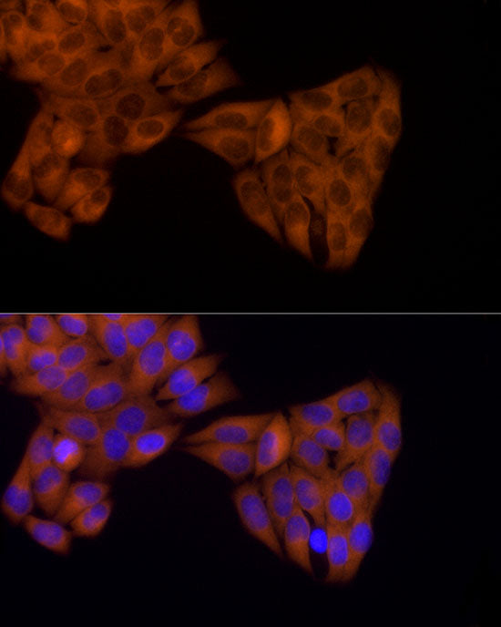 KIF5B Rabbit mAb