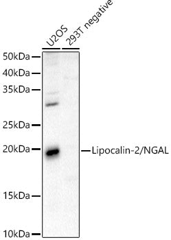 Lipocalin-2/NGAL Rabbit pAb