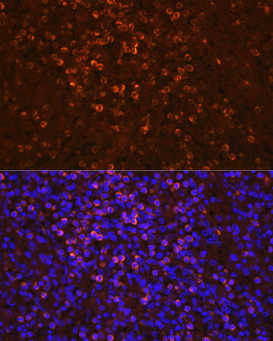 Lipocalin-2/NGAL Rabbit pAb