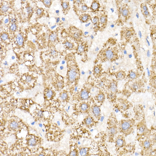 GNAI2 Rabbit mAb