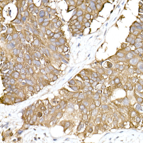 GNAI2 Rabbit mAb