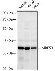 MRPS31 Rabbit mAb