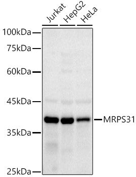 MRPS31 Rabbit mAb