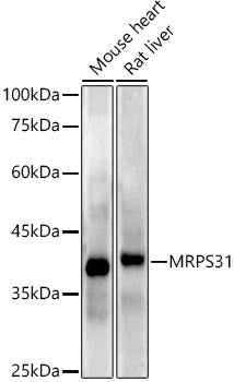 MRPS31 Rabbit mAb