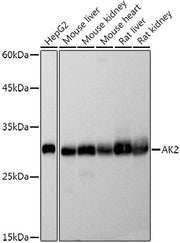 [KO Validated] AK2 Rabbit mAb