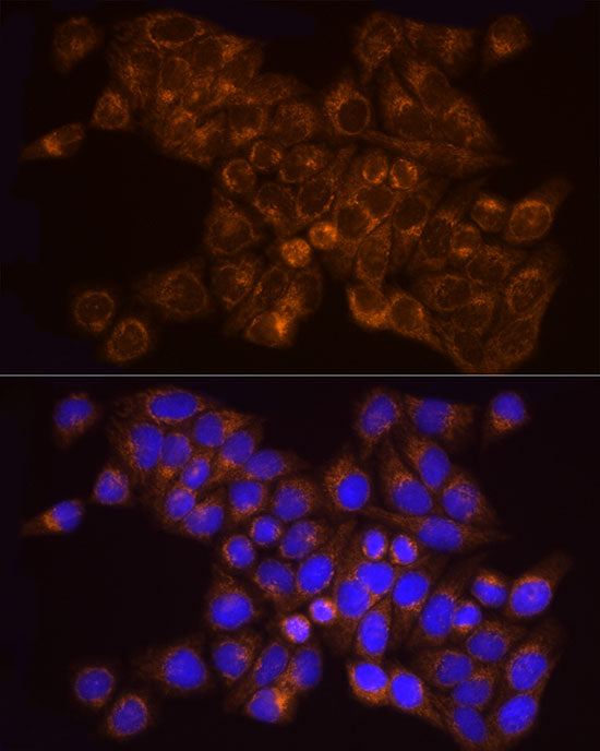 [KO Validated] AK2 Rabbit mAb