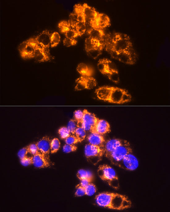 [KO Validated] AK2 Rabbit mAb