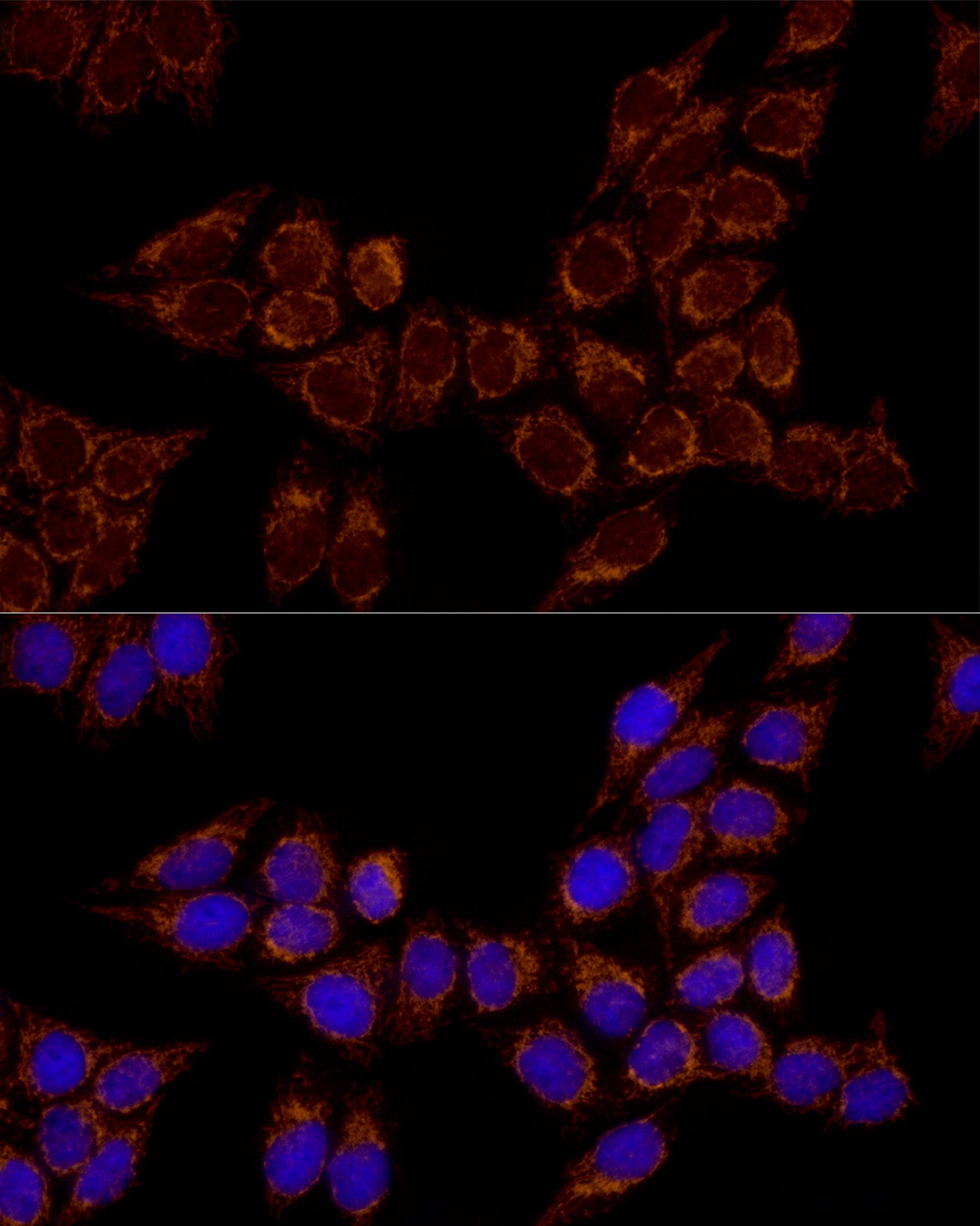 TSFM Rabbit mAb