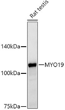MYO19 Rabbit mAb