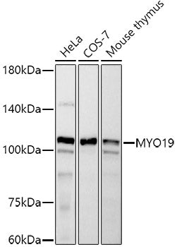 MYO19 Rabbit mAb