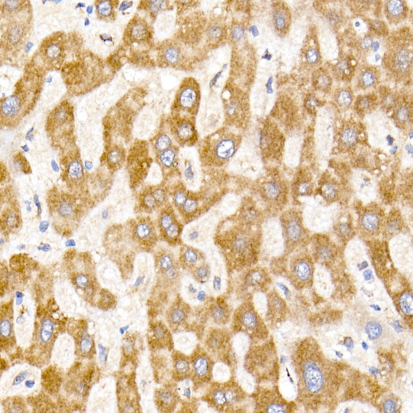 NDUFA1 Rabbit mAb