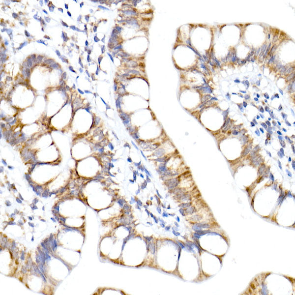 NDUFA1 Rabbit mAb