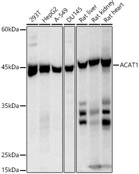 ACAT1 Rabbit mAb