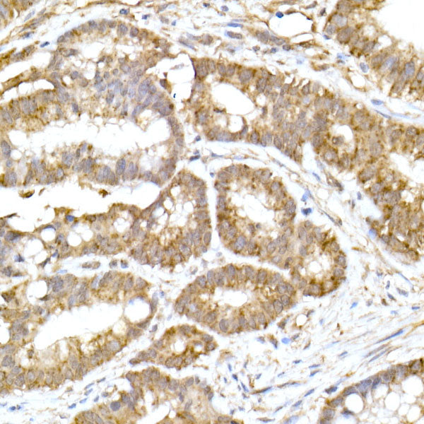 ACAT1 Rabbit mAb