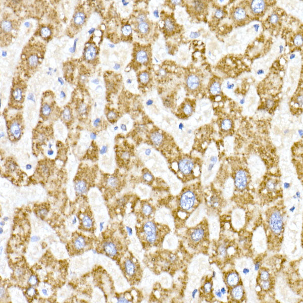 ACAT1 Rabbit mAb