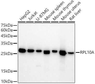 RPL10A Rabbit mAb