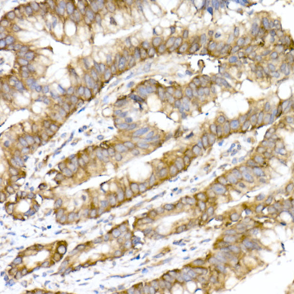 RPL10A Rabbit mAb
