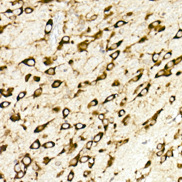 RPL10A Rabbit mAb