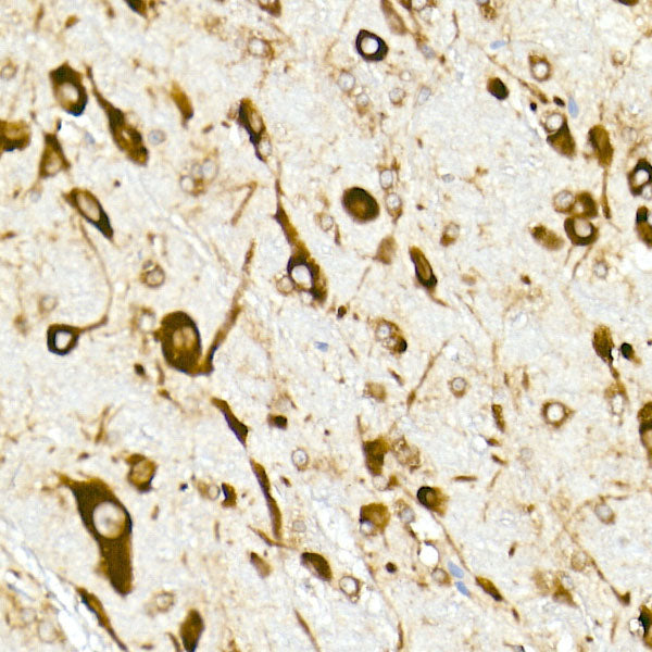 RPL10A Rabbit mAb