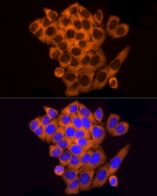 RPL10A Rabbit mAb