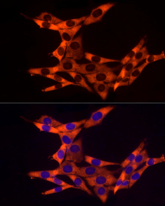 RPL10A Rabbit mAb