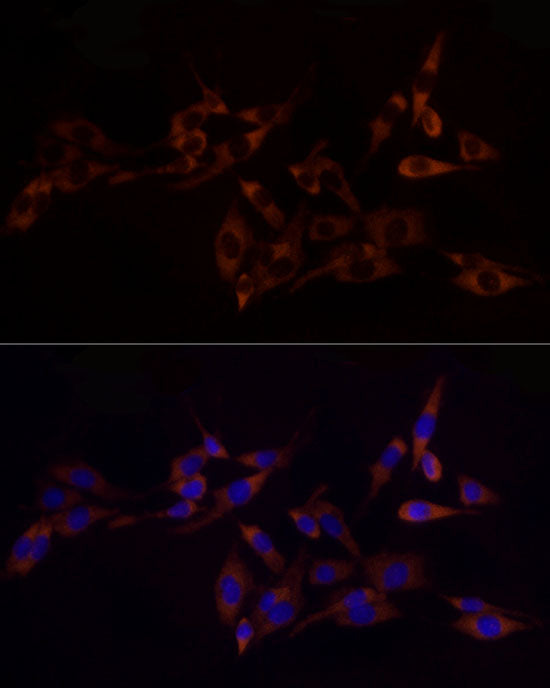 RPL10A Rabbit mAb