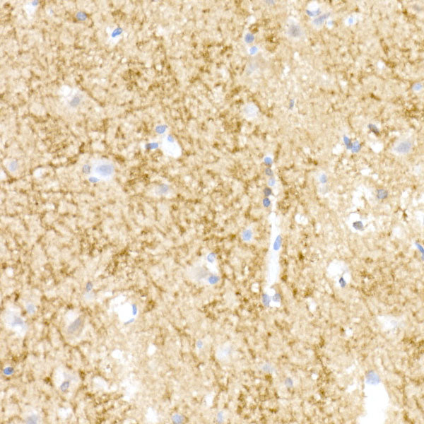 NgR3 Rabbit mAb