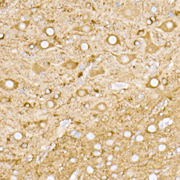 NgR3 Rabbit mAb